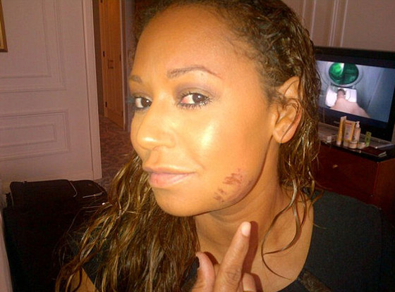 Mel B, Mel B,